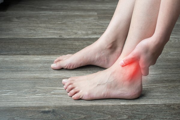 Ankle+Arthritis